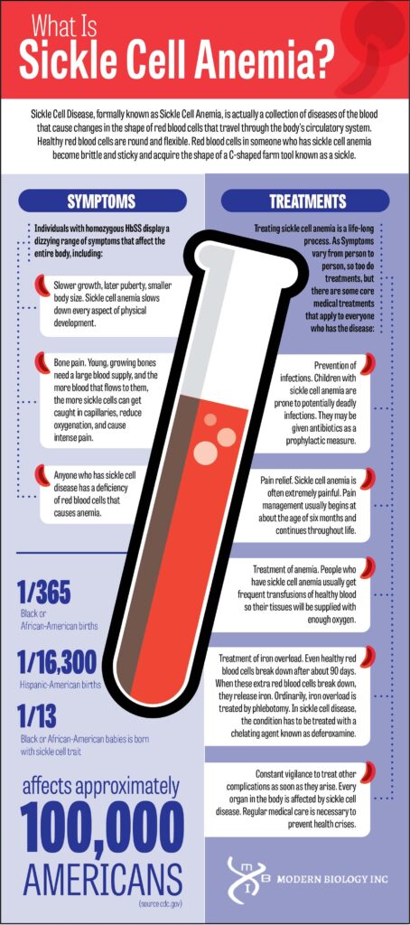 sickle cell symptoms and treatment