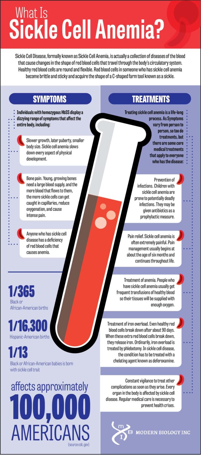 what-is-sickle-cell-anemia-modern-biology-inc